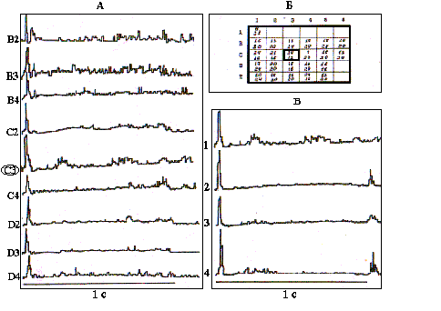 Билатеральные комплексы бочонковых колонок первичной соматосенсорной коры мозга являются модулями восприятия пространства