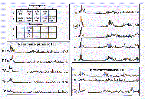 Билатеральные комплексы бочонковых колонок первичной соматосенсорной коры мозга являются модулями восприятия пространства